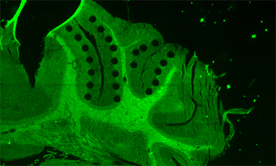 Integrated analysis to understand the tissue in single-cell level-2